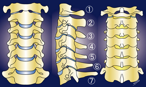頚椎（けいつい） Cervical - 脊椎脊髄の病気と治療