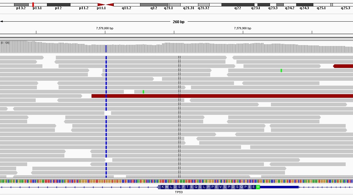 バリアントの評価について Genome Clinic ページ