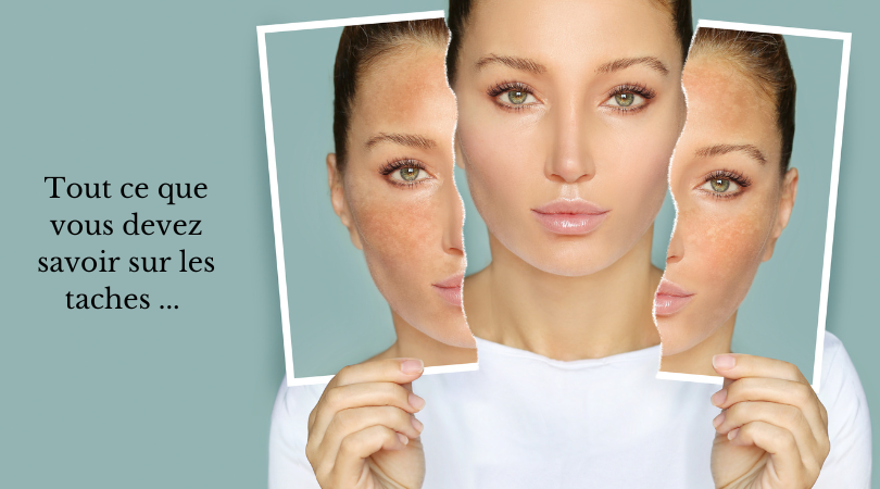 Tout ce que vous devez savoir sur les tâches du visage
