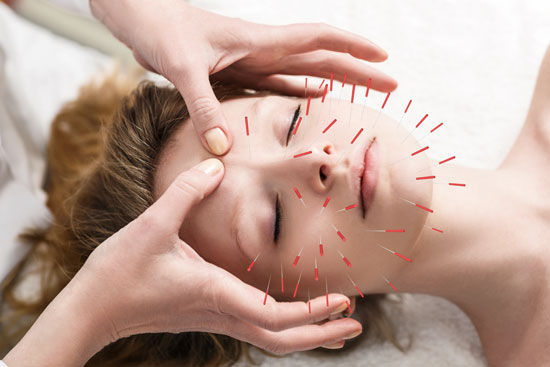 Anti Aging durch Akupunktur - bringt das was?