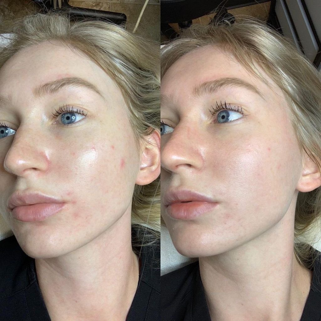 Anti Aging Behandlung Hürth