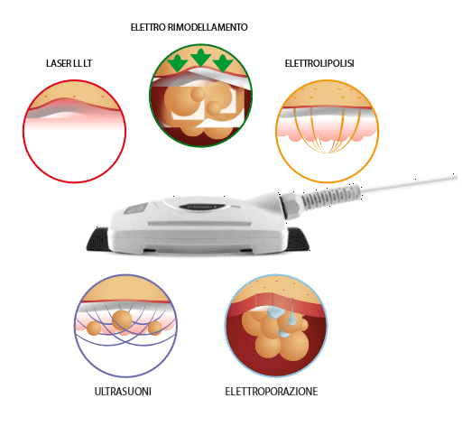 apparecchiatura trattamenti corpo