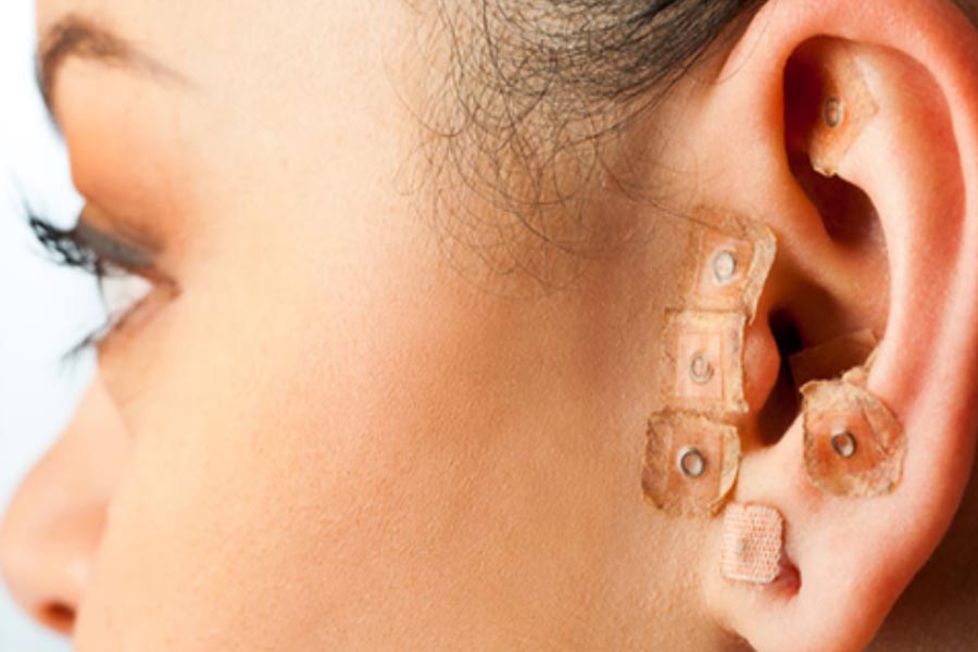 Ohr-Akkupunktur - eine gute Alternative