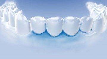 Parodontitis Zahnarzt An Der Residenz Dr David Muller