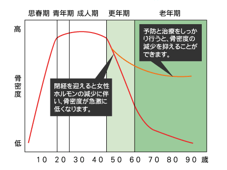 年齢と骨密度の減少過程を表すグラフ