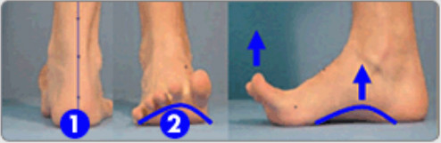 BarefootScienceインソールを使用後の足