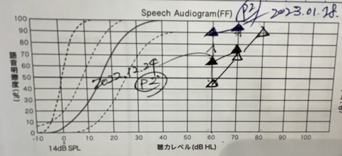 明瞭度測定