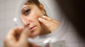 Hauterkrankungen wie Neurodermitis (atopisches Ekzem), Psoriasis (Schuppenflechte), Vitiligo (Weissfleckenkrankheit), Akne, Rosacea, periorale Dermatitis, dyshidrotisches Ekzem, nummuläres Ekzem, Lichen simplex oder Pityriasis