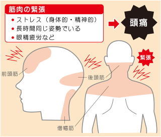 自律神経と頭痛の関係