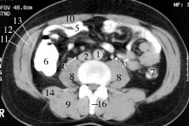 Anatomia narządów miednicy - fizjoterapeuta poleca.