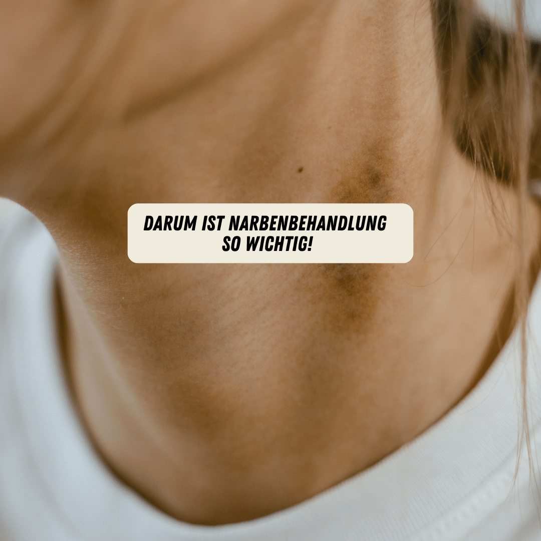 Narbenbehandlung Kosmetik