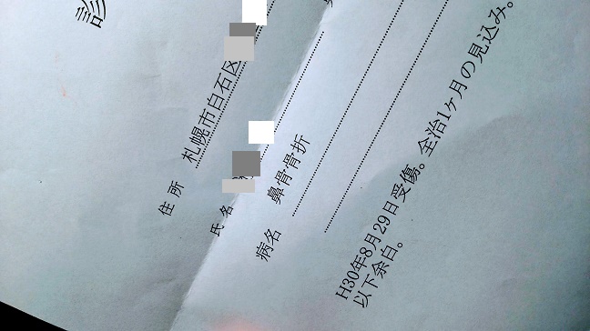 鼻骨折