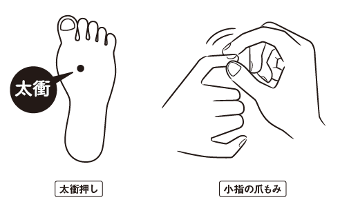 辻敦哉著『世界一簡単な髪が増える方法』より抜粋イラスト　O字タイプ別薄毛の予防法