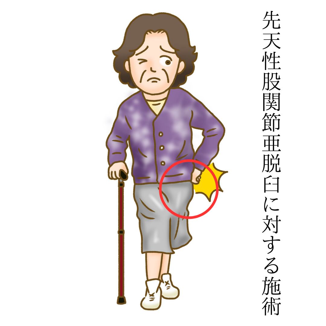 ●先天性股関節亜脱臼　しゃがめない、下半身に力が入りにくい　静岡県磐田市