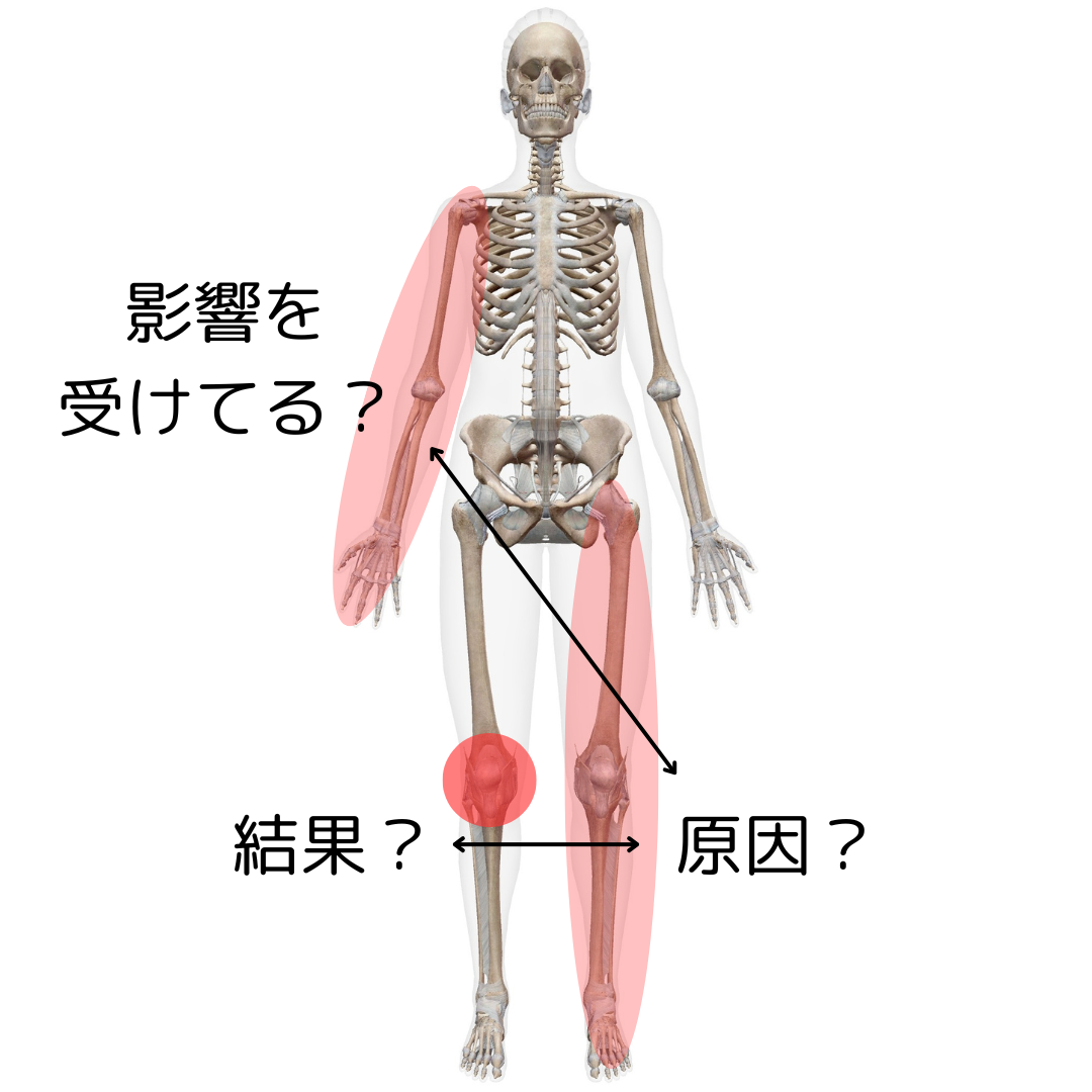 ●膝痛　上半身の影響もある？　京都市