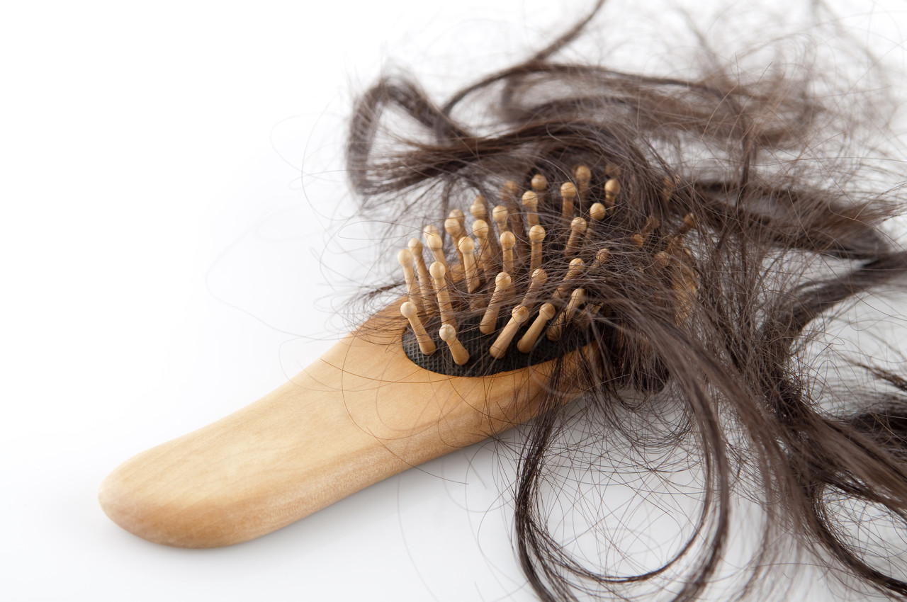 Was Kann Man Gegen Kreisrunden Haarausfall Tun Alopecia Areata Schweiz Kreisrunder Haarausfall
