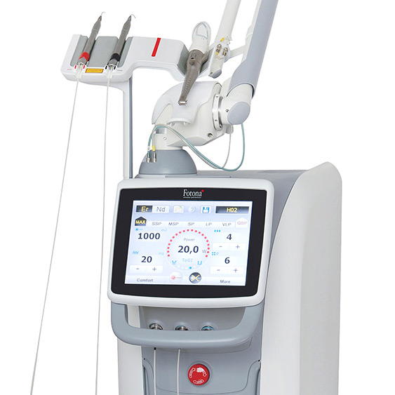 Wurzelkanalbehandlung / A.R.C. Laser