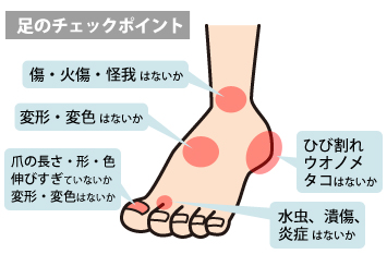 糖尿病合併症 神経障害 Healthlabo ホーム 糖尿病合併症 神経障害 Healthlabo ホーム