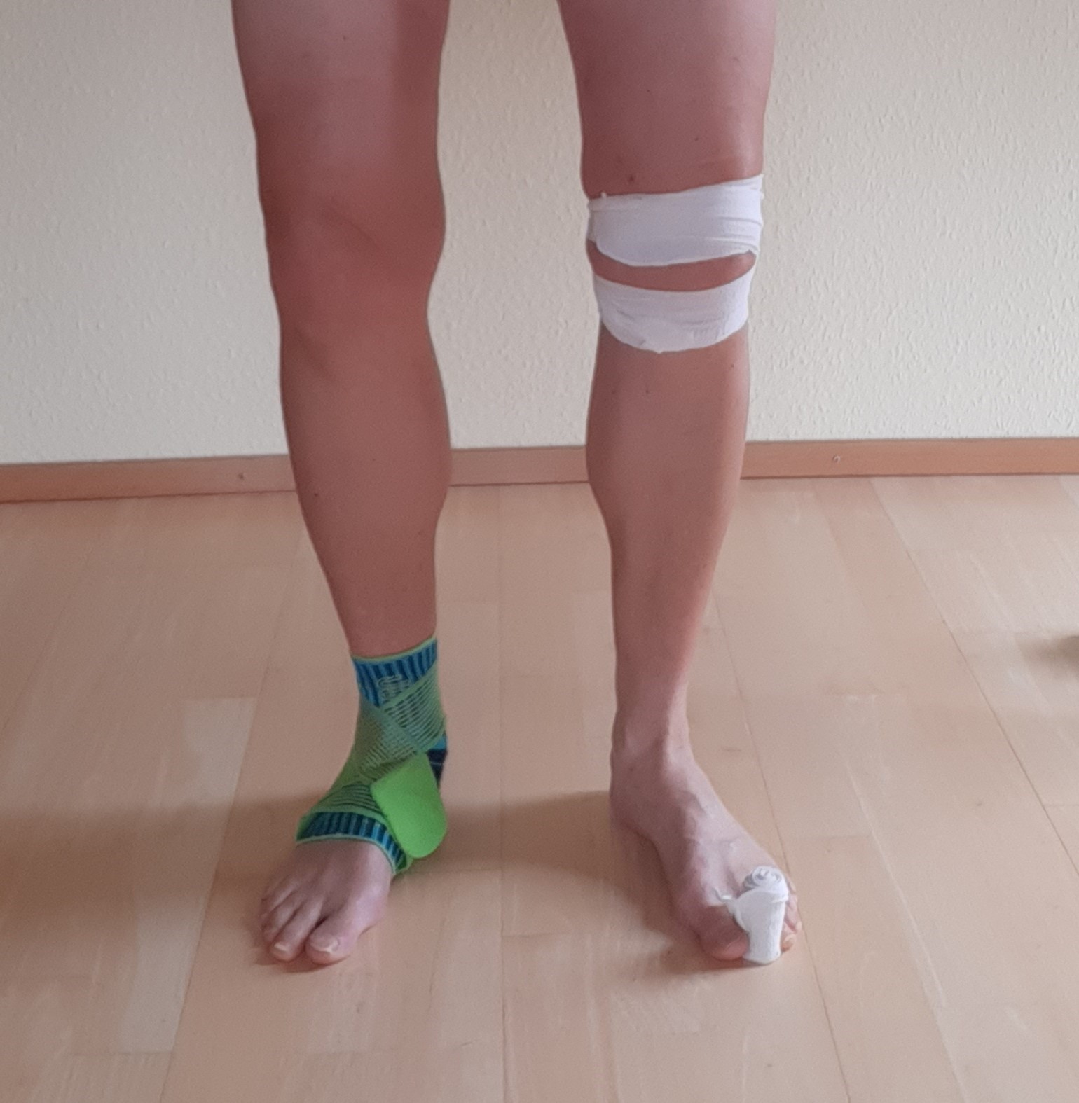 Sehnenscheidenentzundung Fuss Wie Lange Krank