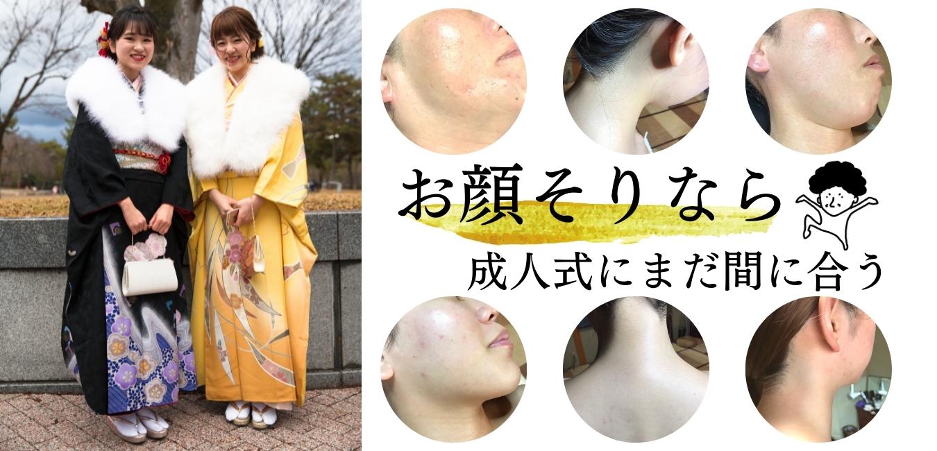 お顔そりなら成人式にまだ間に合う