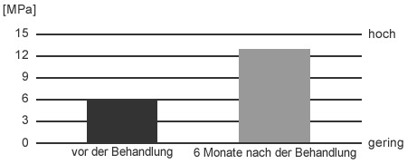 Cellulite - Behandlung mit Stosswellen in Aarau