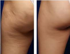 Celebrity Miss Derriere