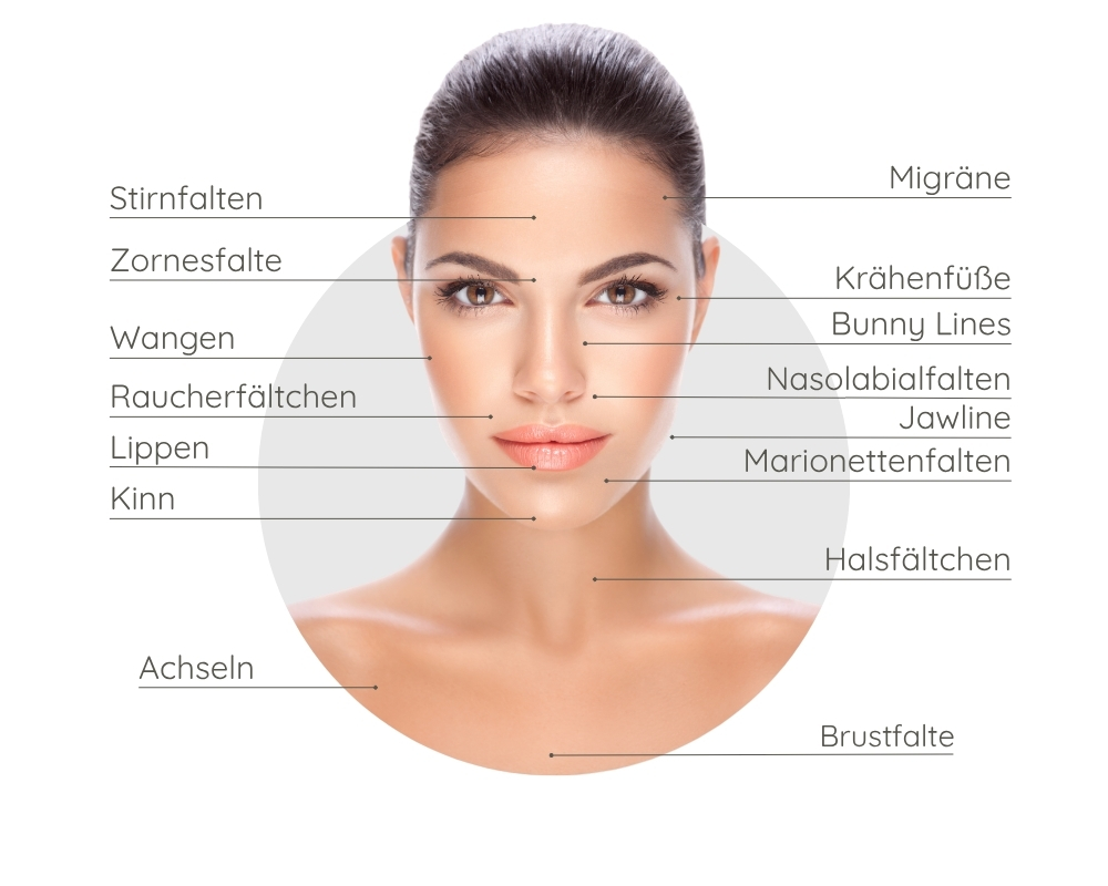 Einsatzbereiche Bio Botox