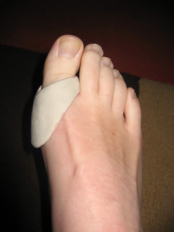 Ballenschale - zum Schutz vor Druck und Reibung des Schuhes am Großzehengrundgelenk