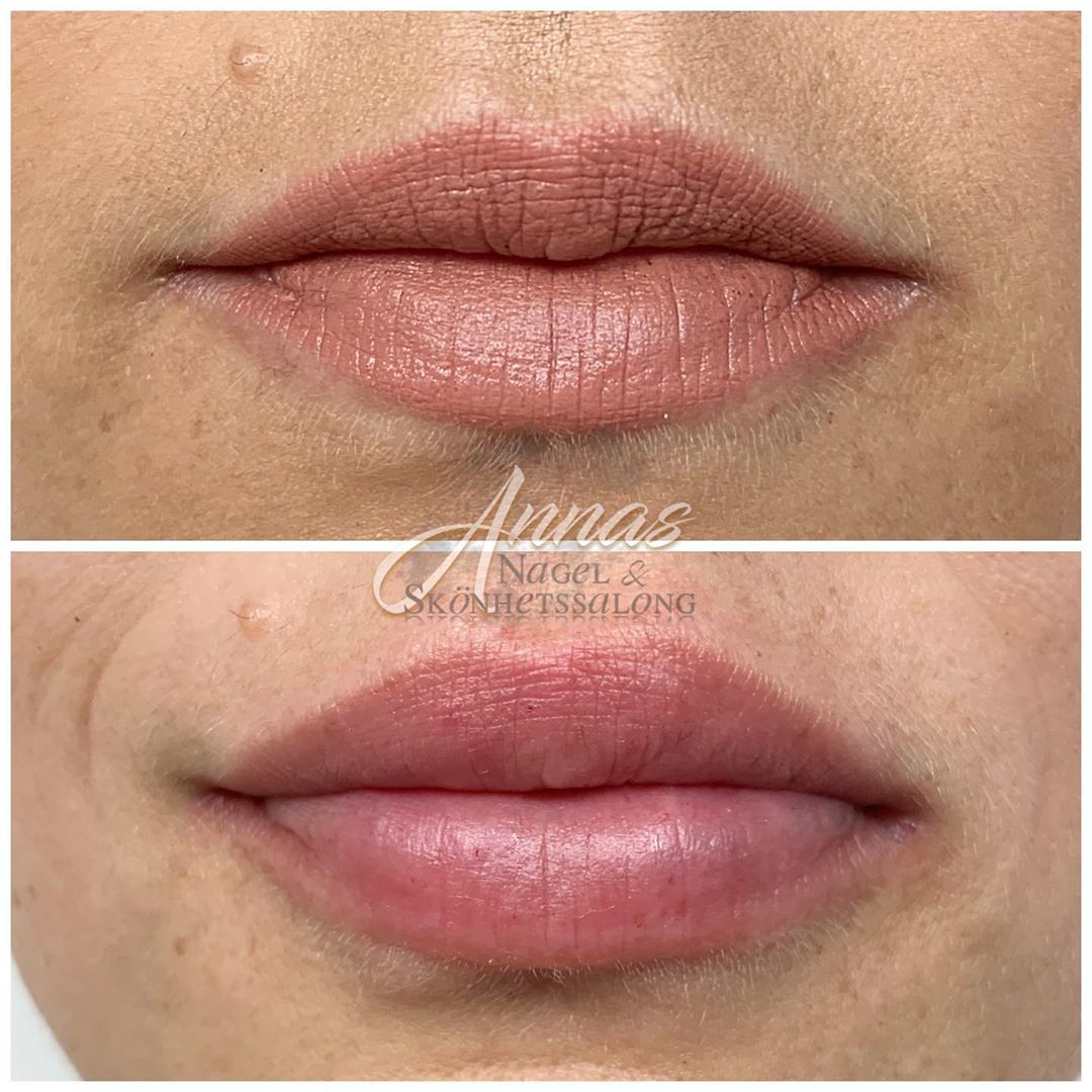 YAVU IRI medical pen Lyxeriet Skönhet & Hälsa i Enköping