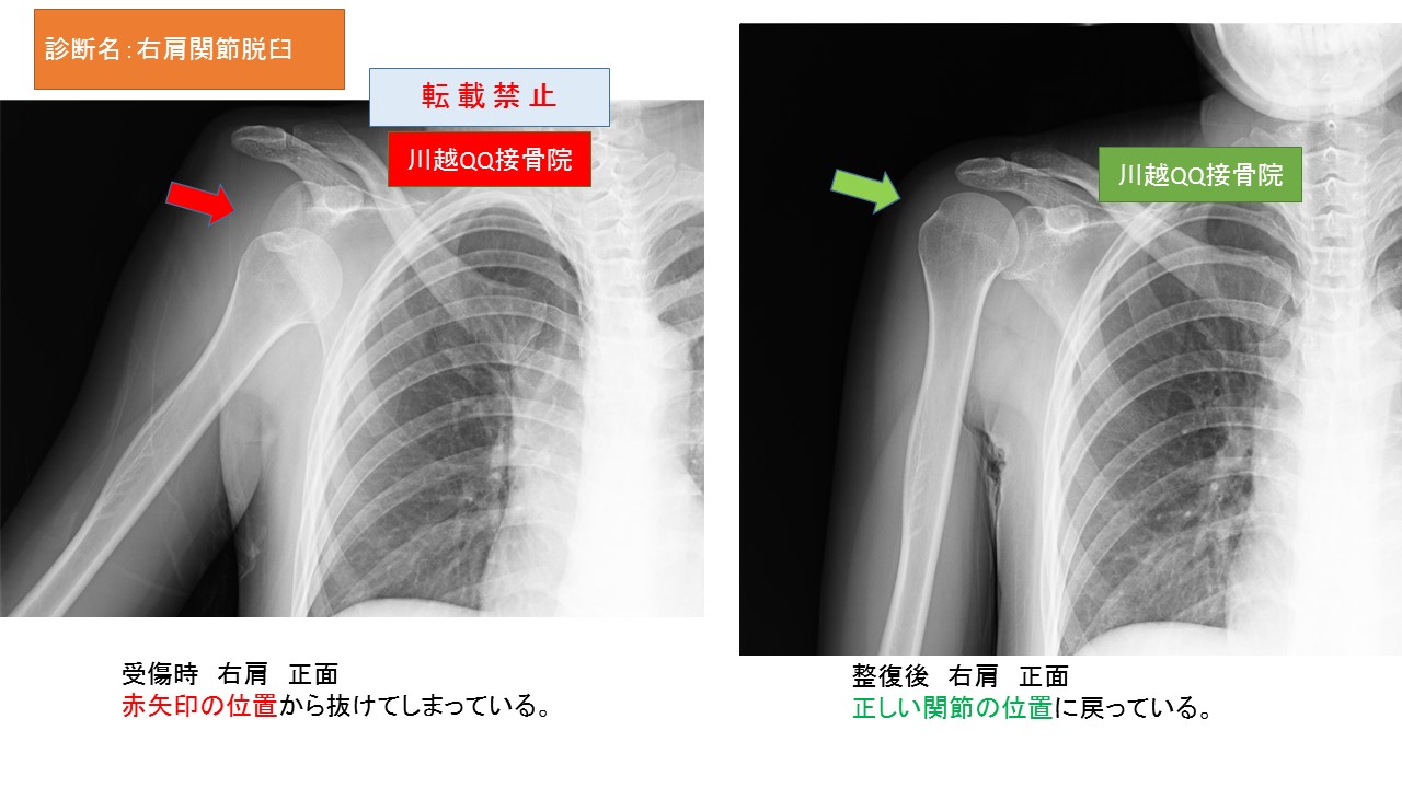Amazon.co.jp: 当直でよく診る骨折・脱臼・捻挫《研修医☆万里