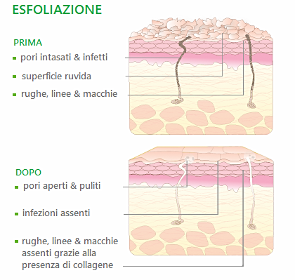 Risultato sulla pelle prima e dopo l'esfoliazione