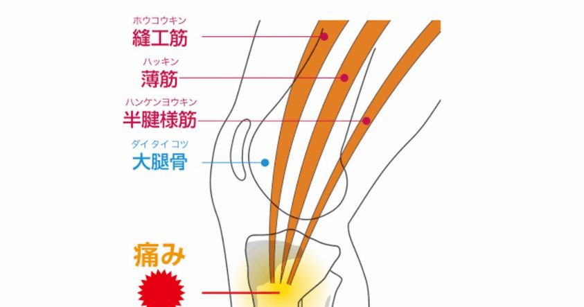 膝の痛み改善（膝の内側の痛み）