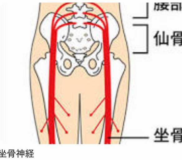 坐骨神経痛！その痛みをとるには何が必要か？