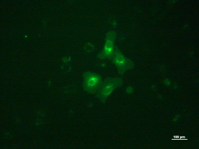 Oral squamous cancer cell stained with fluorescence dye. Photo credit to Xin Hui.