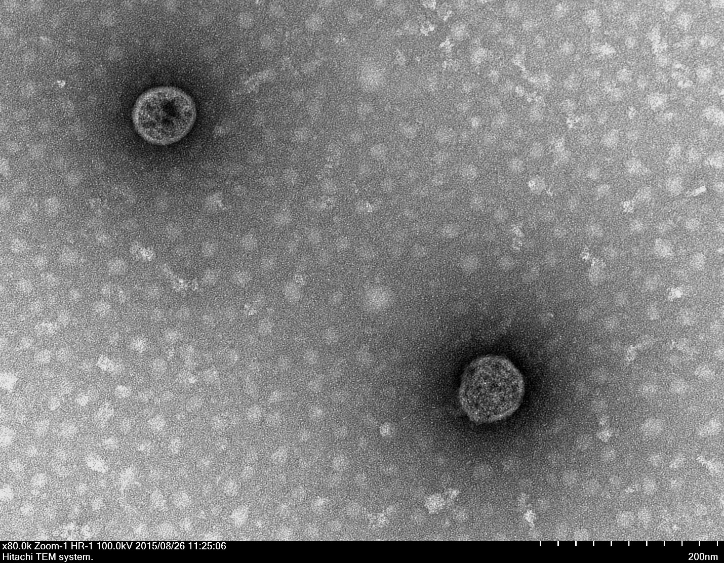 TEM image of HT29-derived exosome. Photo credit to Shu Kee. 