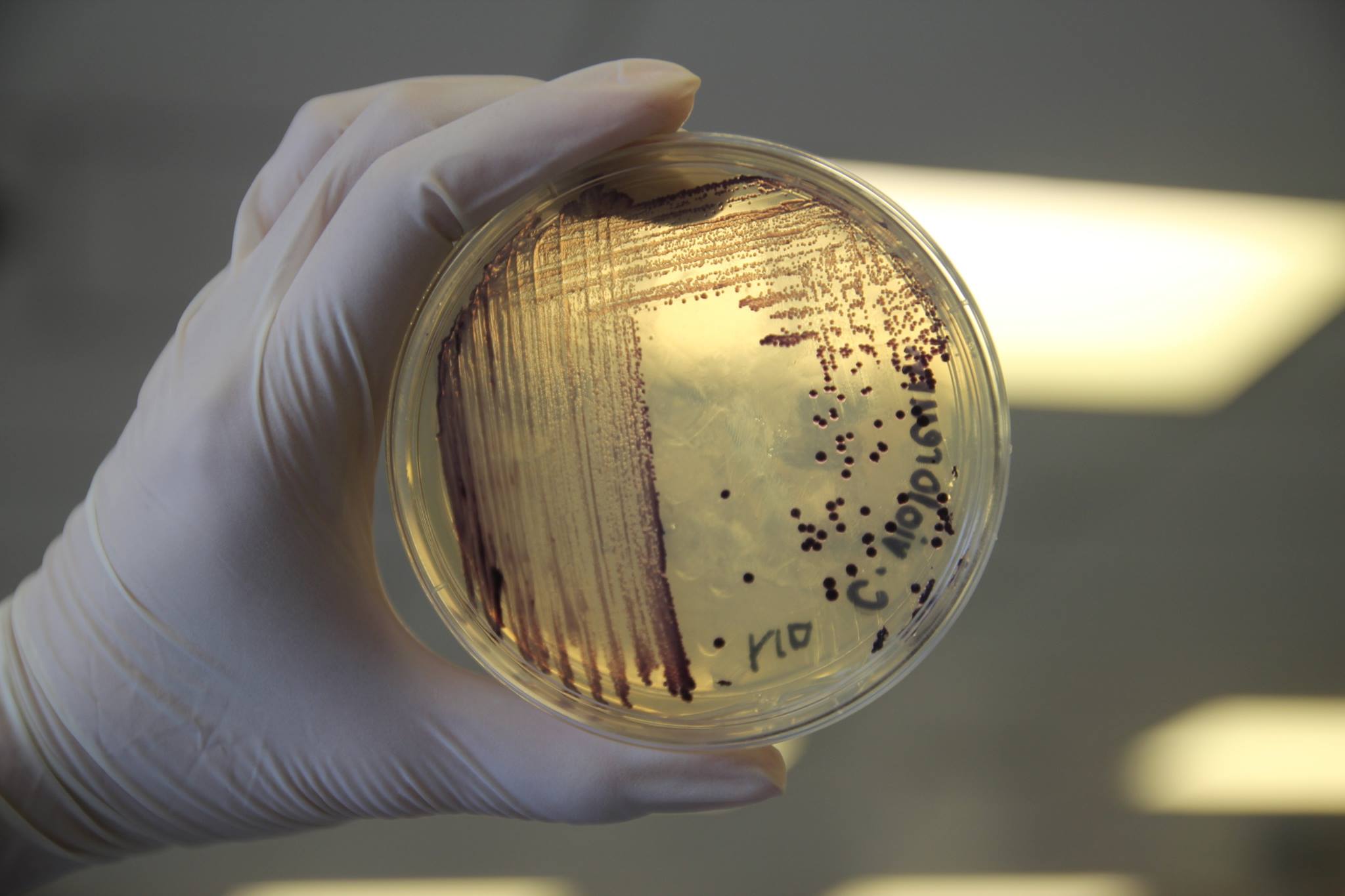 Chromobacterium violaceum on nutrient agar. Photo credit to Kak Ming. 