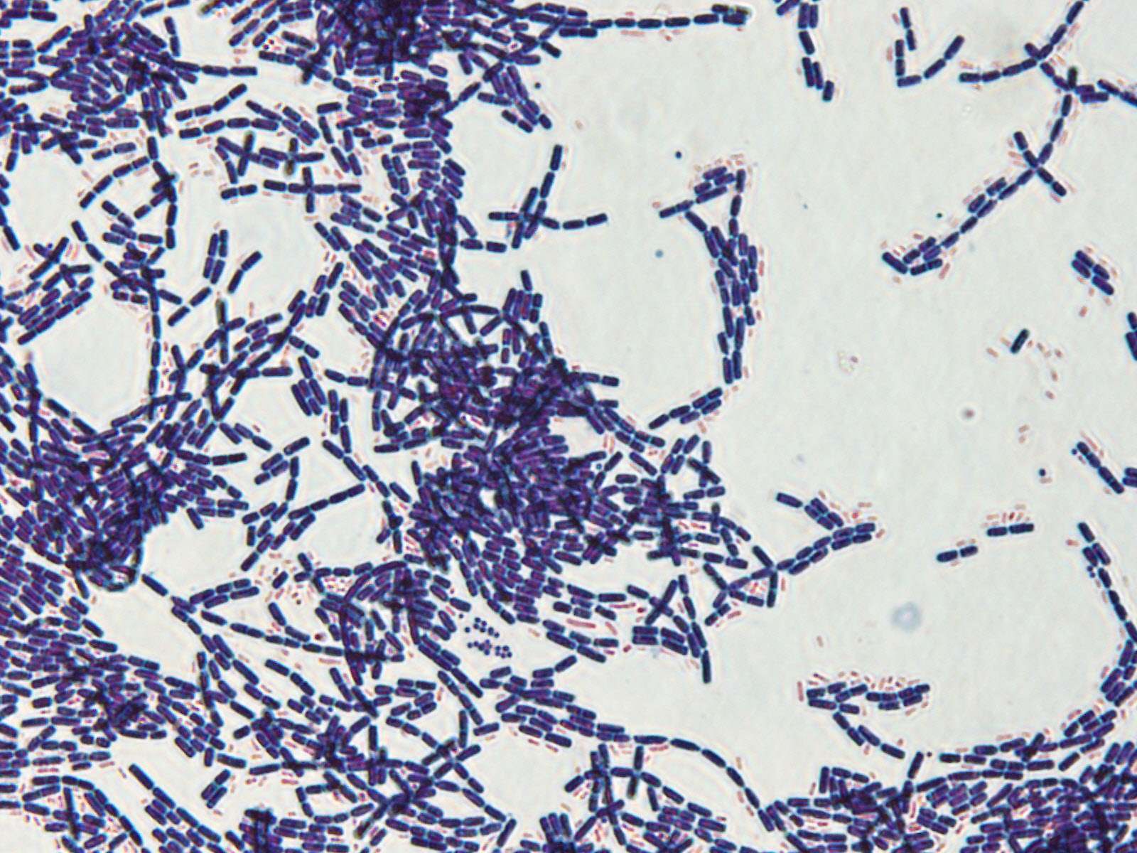 Gram staining. Photo credit to Amreeta.