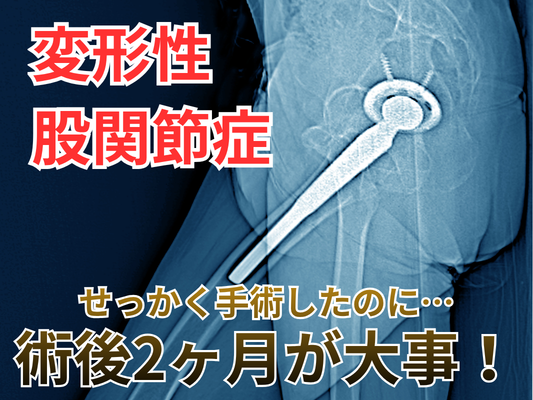 柏市｜人工股関節置換術後、数日〜１週間で退院した方必見！｜術後リハビリのセカンドオピニオン