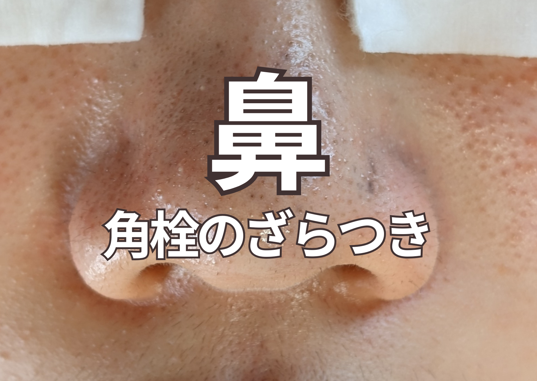 毛穴に悩まない未来をすることが目的
