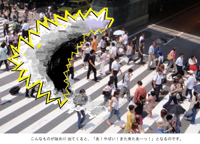 閃輝暗点のイメージ画像
