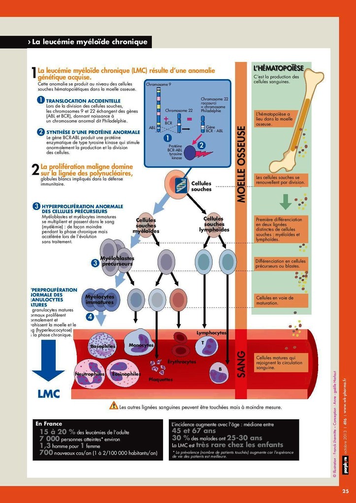 La leucémie myéloïde chronique en schémas