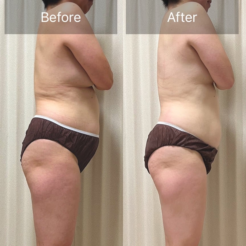 【お客様の変化】人生初ダイエットに挑戦！