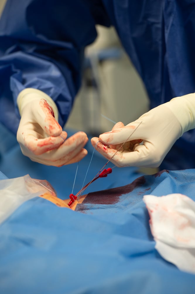 Accueil des patients Covid au sein du service réanimation du CHD Vendée - Resuscitation service for Covid patients (2020)