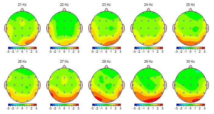 Analyse - Aktivitätsverteilung