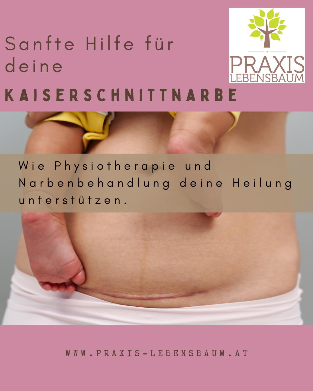 Sanfte Hilfe für deine Kaiserschnittnarbe – Wie Physiotherapie und Narbenbehandlung deine Heilung unterstützen