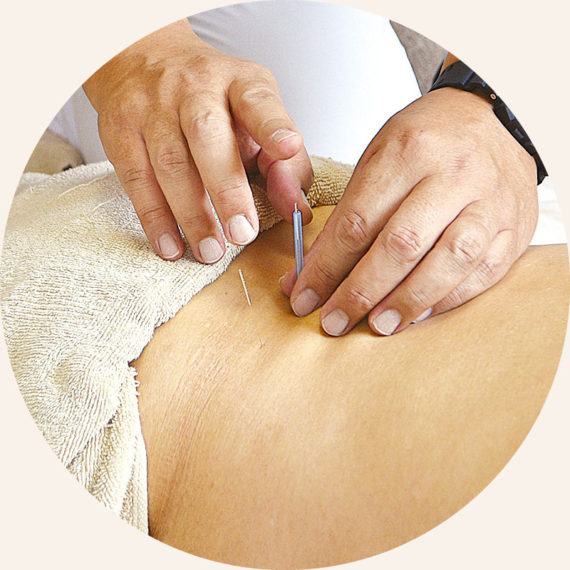 鍼療法｜西山鍼灸院（新潟市中央区本町通）