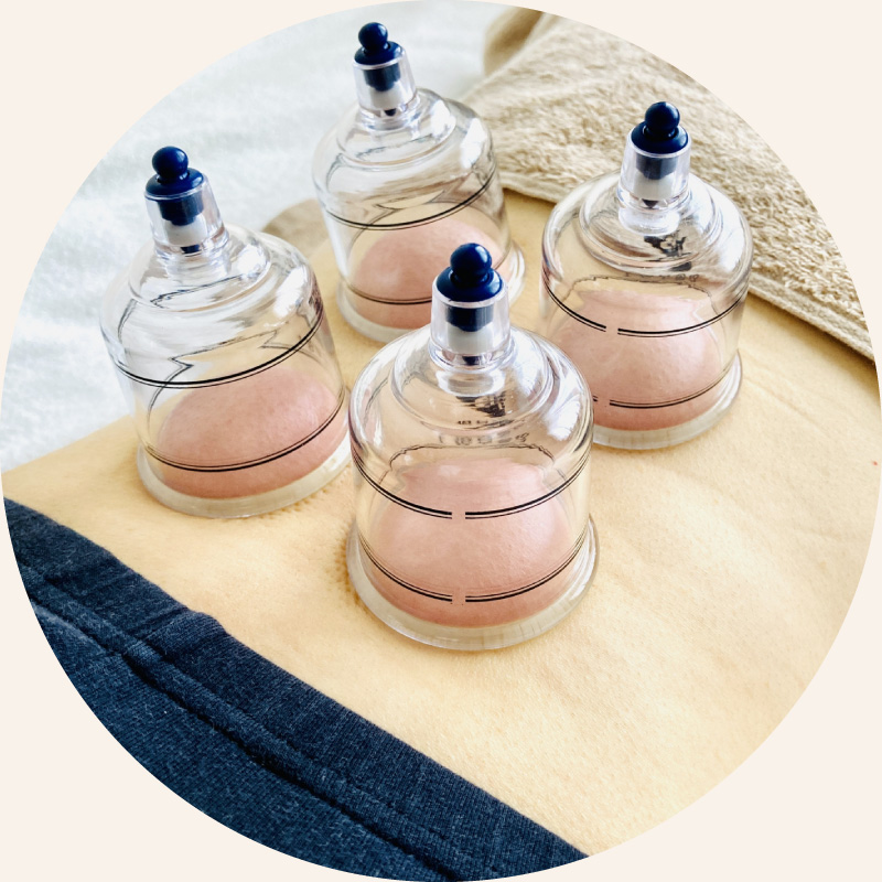 吸い玉療法｜西山鍼灸院（新潟市中央区本町通）