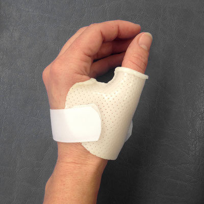 Ergotherapie Stein am Rhein und Berlingen, Handtherapie und Schienenherstellung, Schmerztherapie