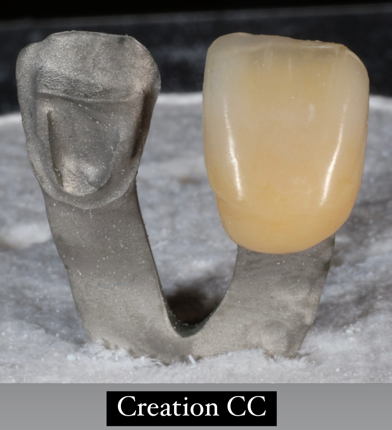 Case-3 Metal Ceramic