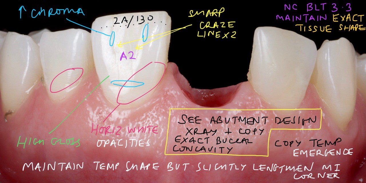 Case-2 Single Central Implant Zr Crown